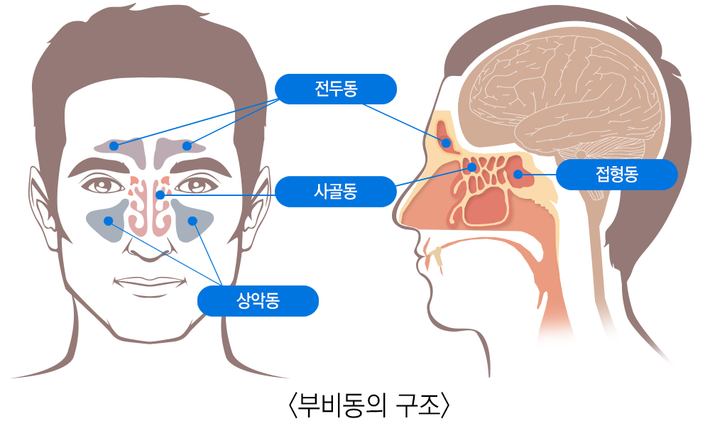 치매예방